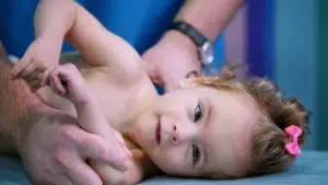 A doctor examines a smiling baby with cerebral palsy.